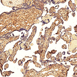 sars-cov-2 gene expression in a human fetus